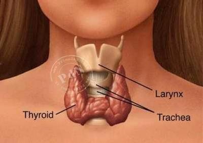 tiroide